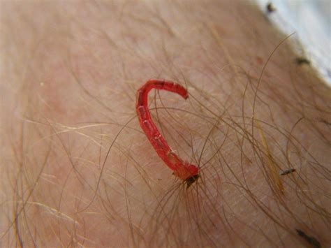 Can red worms bite?