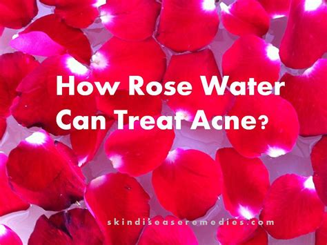 Can rose water clog pores?
