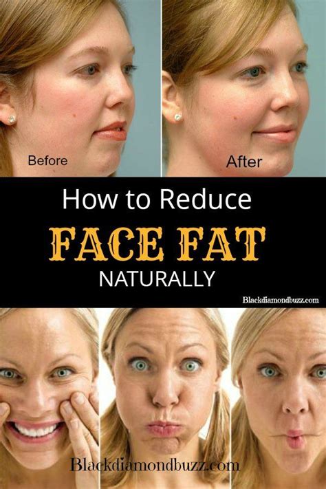 Can running reduce face fat?