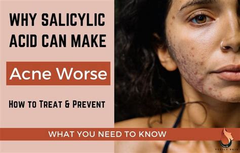 Can salicylic acid cause acne?