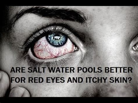 Can salt damage your eyes?