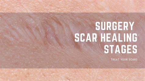 Can scars ever fully heal?