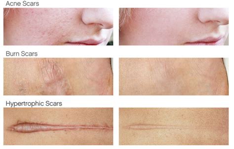 Can scars fade after 2 years?