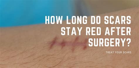Can scars stay red forever?