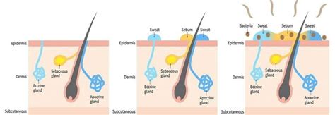 Can sebum hair loss reversed?