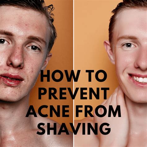 Can shaving your back cause acne?
