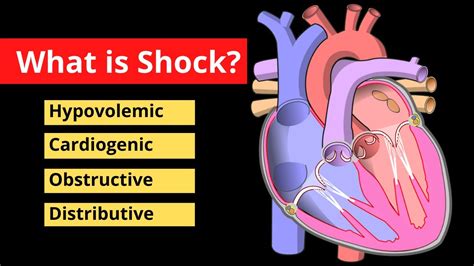 Can shocks last 20 years?