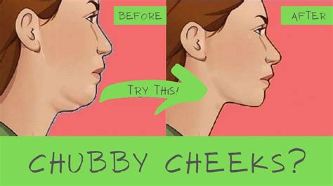 Can skinny people have chubby cheeks?