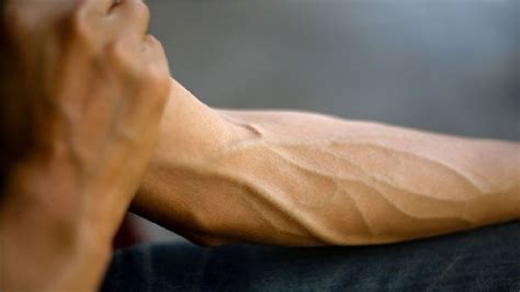 Can skinny people have veiny arms?