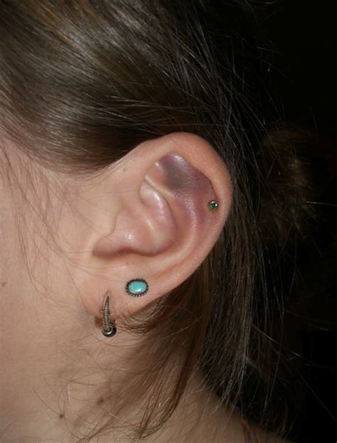 Can sleeping on a piercing cause infection?