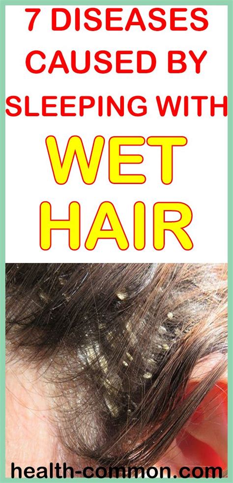 Can sleeping with wet hair cause fungus?