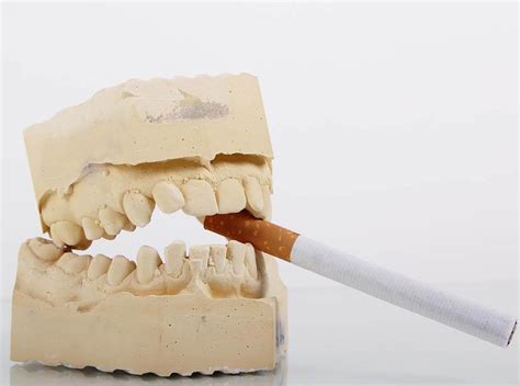 Can smokers teeth be fixed?