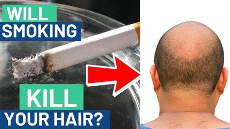 Can smoking cause hair loss?