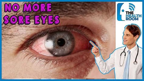Can sore eyes heal in 3 days?