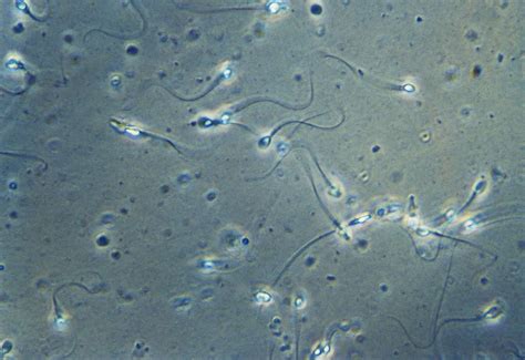 Can sperm survive spermicide?