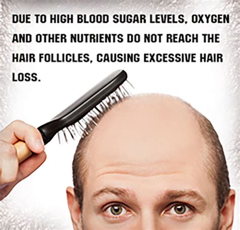 Can sugar cause hair loss?