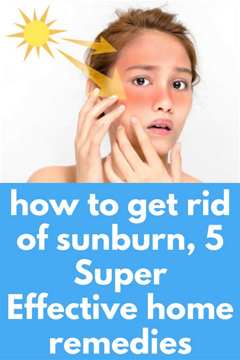 Can sunburn heal naturally?