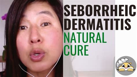 Can sunlight help seborrheic dermatitis?