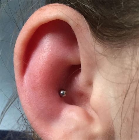 Can swelling make piercings look uneven?