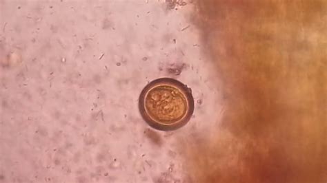 Can tapeworm eggs hatch outside body?