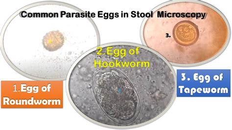 Can tapeworm eggs live on bedding?