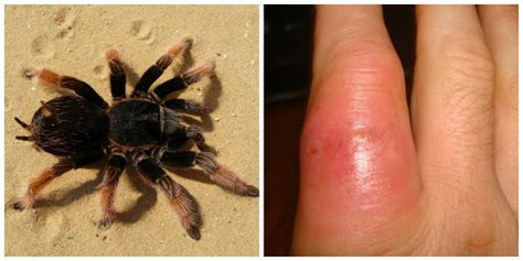Can tarantulas break skin?