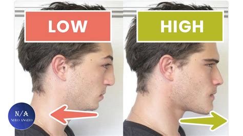 Can testosterone change your face shape?