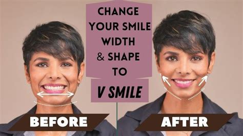 Can the shape of your smile be changed?