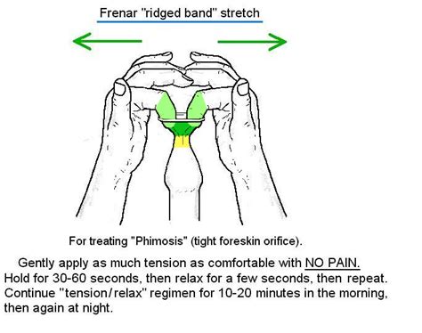 Can tight frenulum be cured?