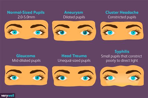 Can tiredness affect pupil size?