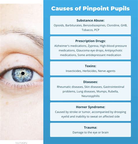 Can tiredness cause pinpoint pupils?