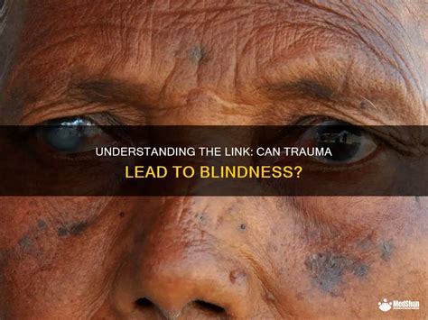 Can trauma cause blindness?