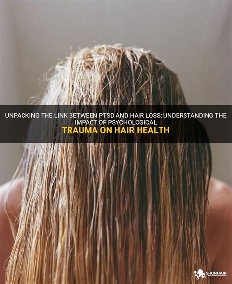 Can trauma cause hair loss?