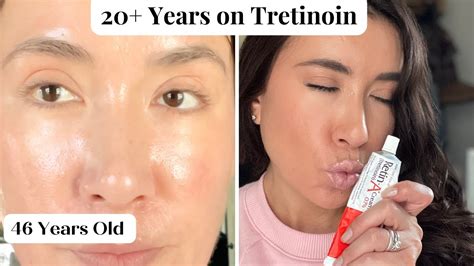 Can tretinoin make you look older?