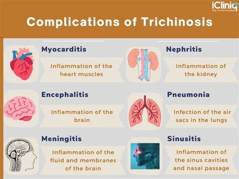 Can trichinosis cause brain damage?