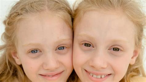 Can twins have twins?