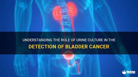 Can urine detect bladder cancer?