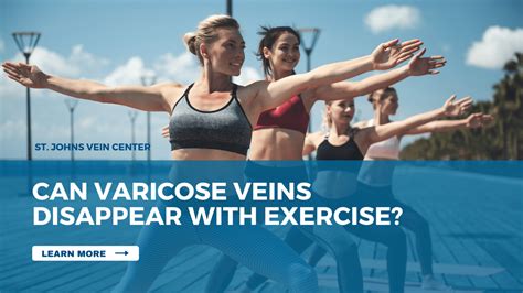 Can veins disappear with exercise?