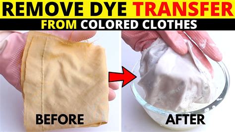 Can vinegar remove dye stains?