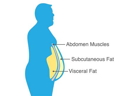 Can visceral fat be visible?