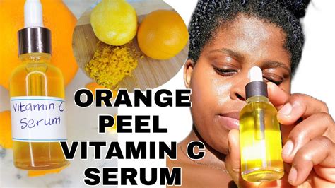 Can vitamin C make your skin lighter?