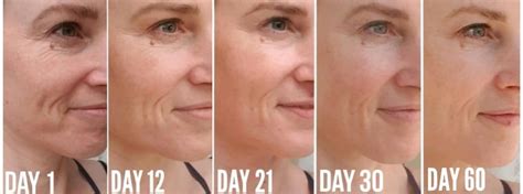 Can vitamin D reverse wrinkles?