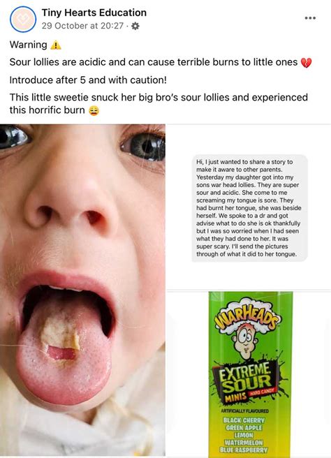 Can warheads damage your mouth?