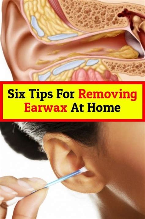 Can warm water remove ear wax?