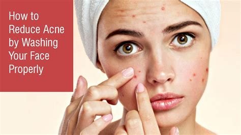 Can washing your face make acne worse?