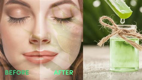 Can we go in sunlight after applying aloe vera on face?