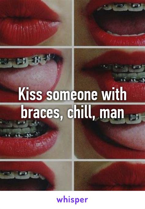 Can we kiss if we have braces?
