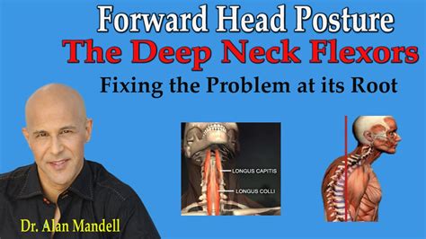 Can weak neck muscles be fixed?