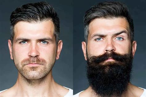 Can white men grow beards?