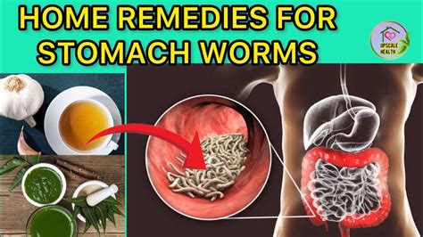 Can worms give you a bloated stomach?